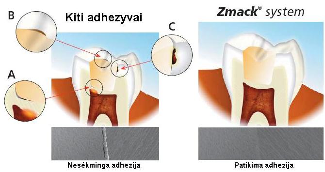 zmackbondpatikimumas.jpg